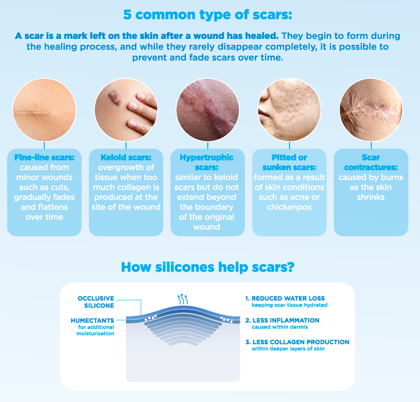 Dermal Scar Treatment Silicone+ Gel - Treats Old And New Scars