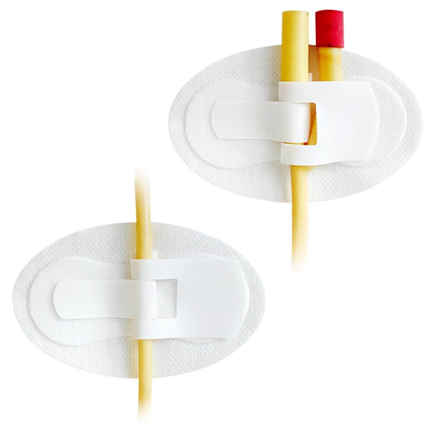 Catheter Securement Device: 4-Pack Stabilisation Leg Band for Foley Catheters