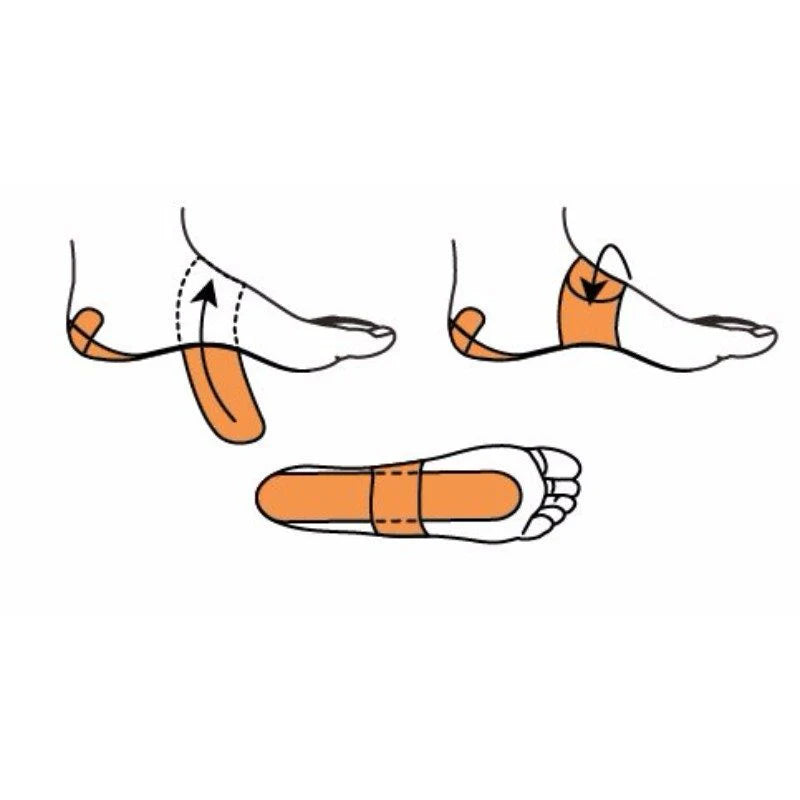 Mueller FasciaDerm PFTape System for Plantar Fasciitis - Instant Relief for Heel and Arch Pain