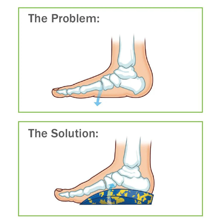 Talarmade 4Kids Orthotics for Paediatric Plano-Valgus Feet - Medial Posting for Support and Stability