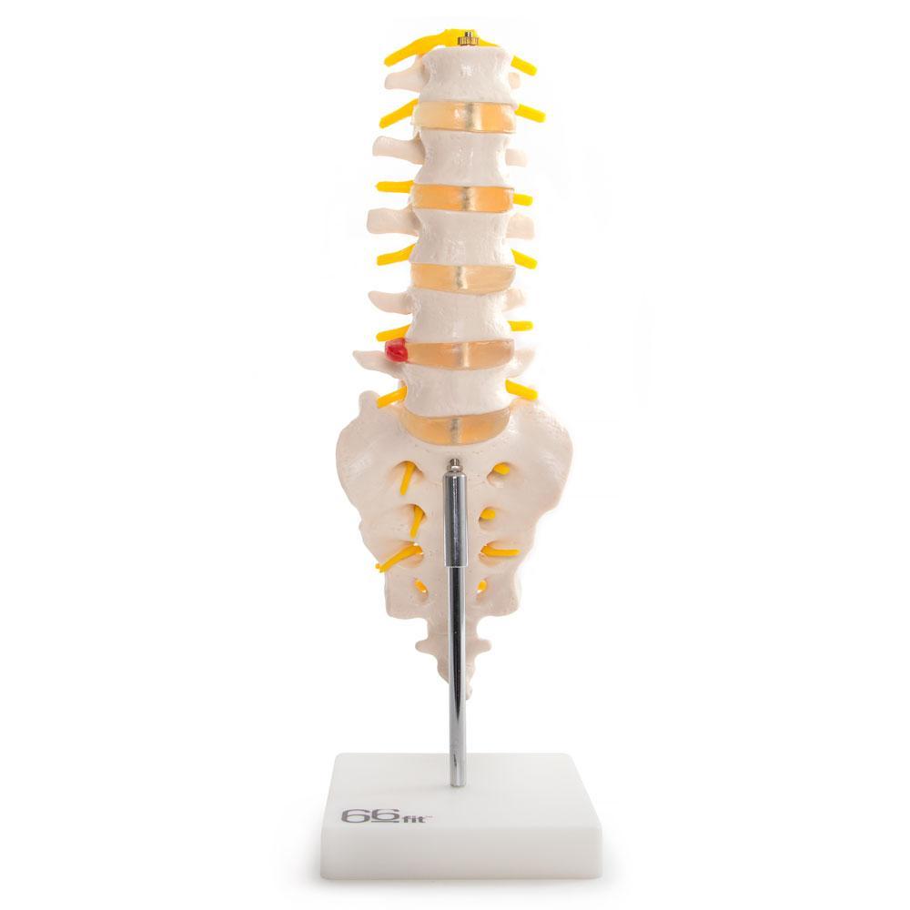 Anatomical Lumbar Vertebrae with Sacrum, Coccyx & Herniated Disc Model - Ideal for Medical Training, Education & Healthcare