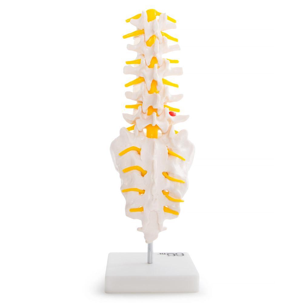 Anatomical Lumbar Vertebrae with Sacrum, Coccyx & Herniated Disc Model - Ideal for Medical Training, Education & Healthcare