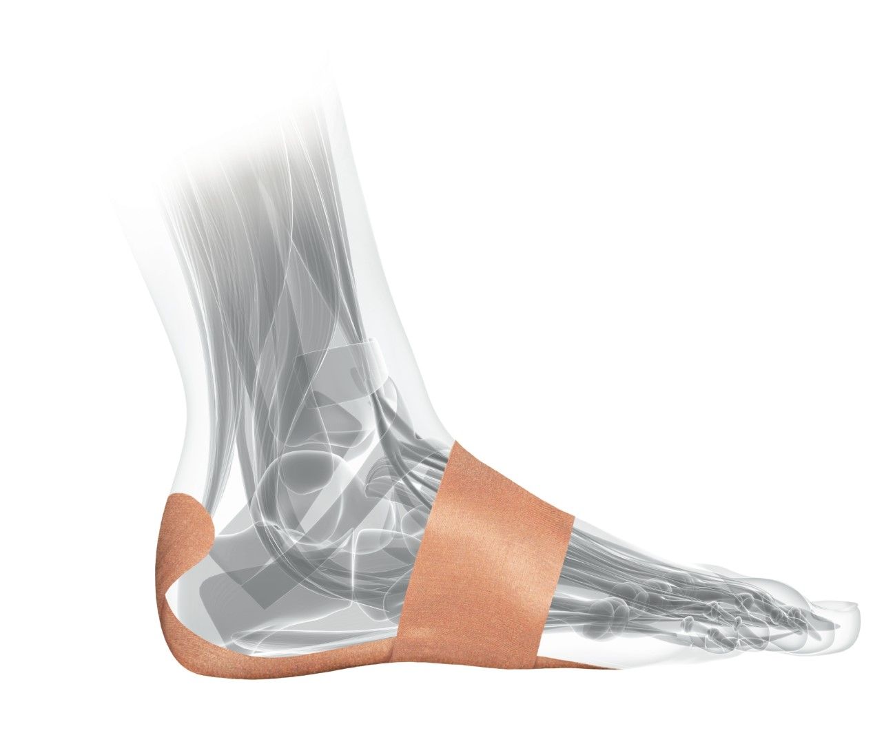 Mueller FasciaDerm PFTape System for Plantar Fasciitis - Instant Relief for Heel and Arch Pain