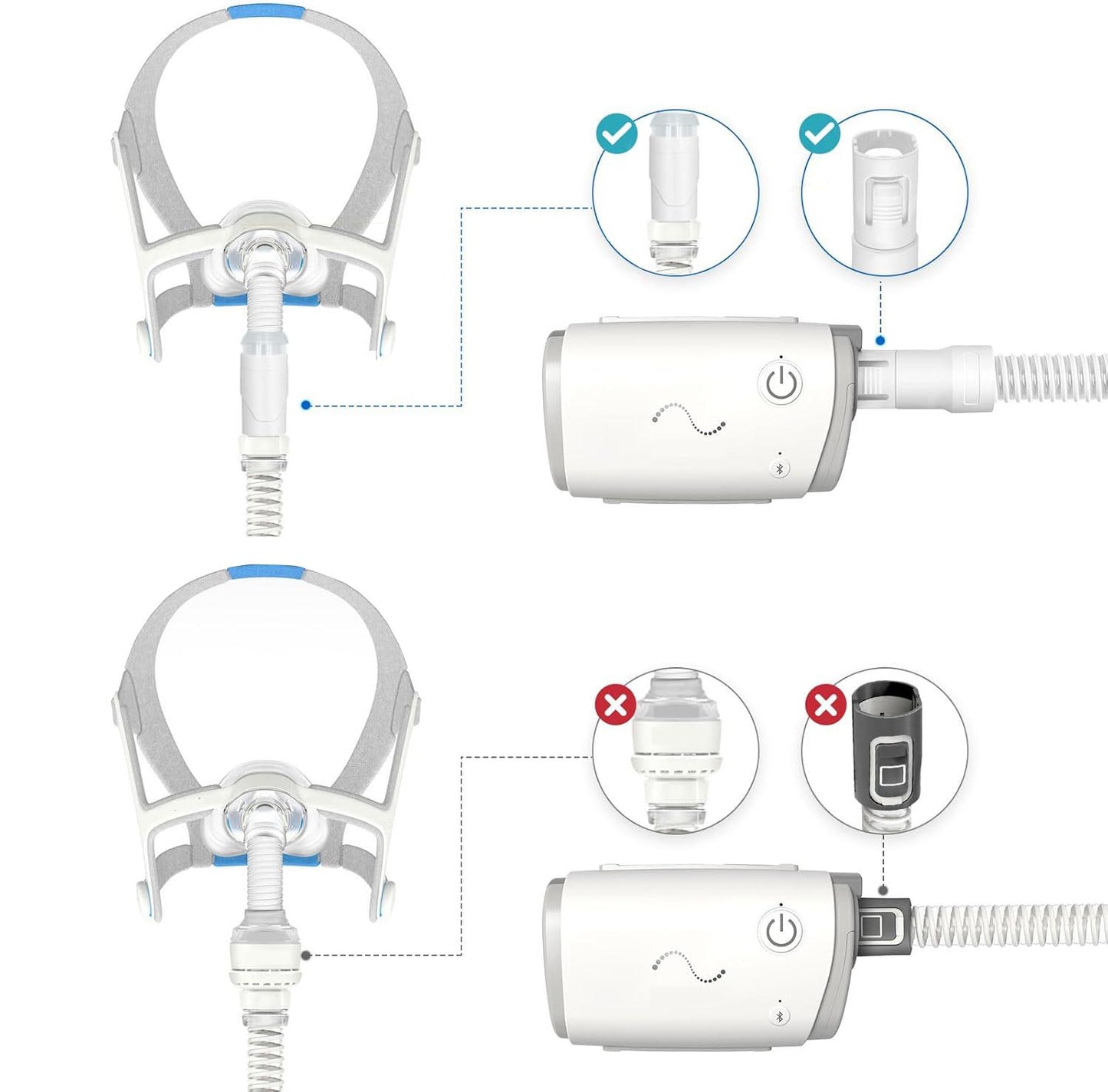 Adapter Set for ResMed AirMini CPAP Machines | 15mm & 22mm Tube Compatibility