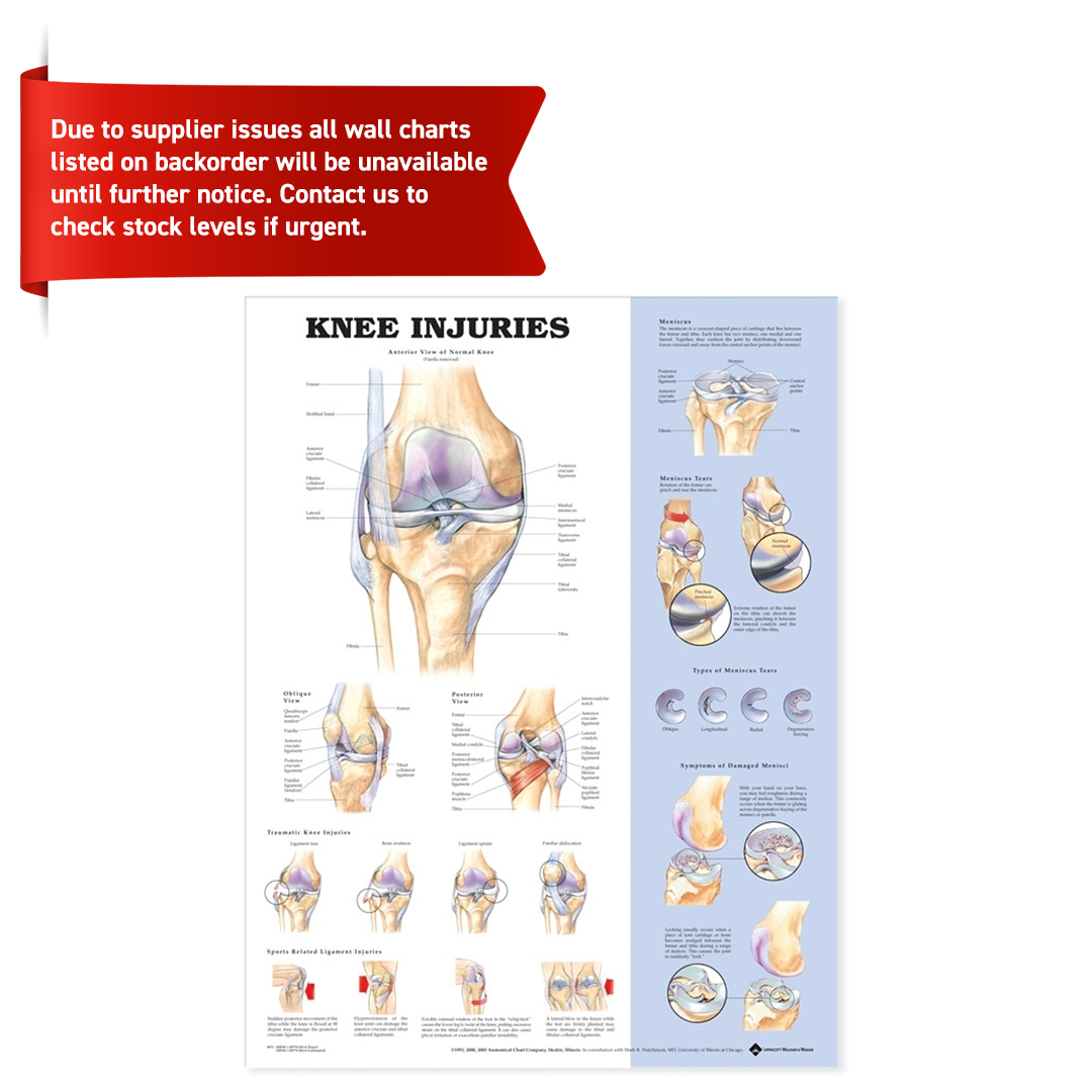Knee Injuries Anatomical Chart