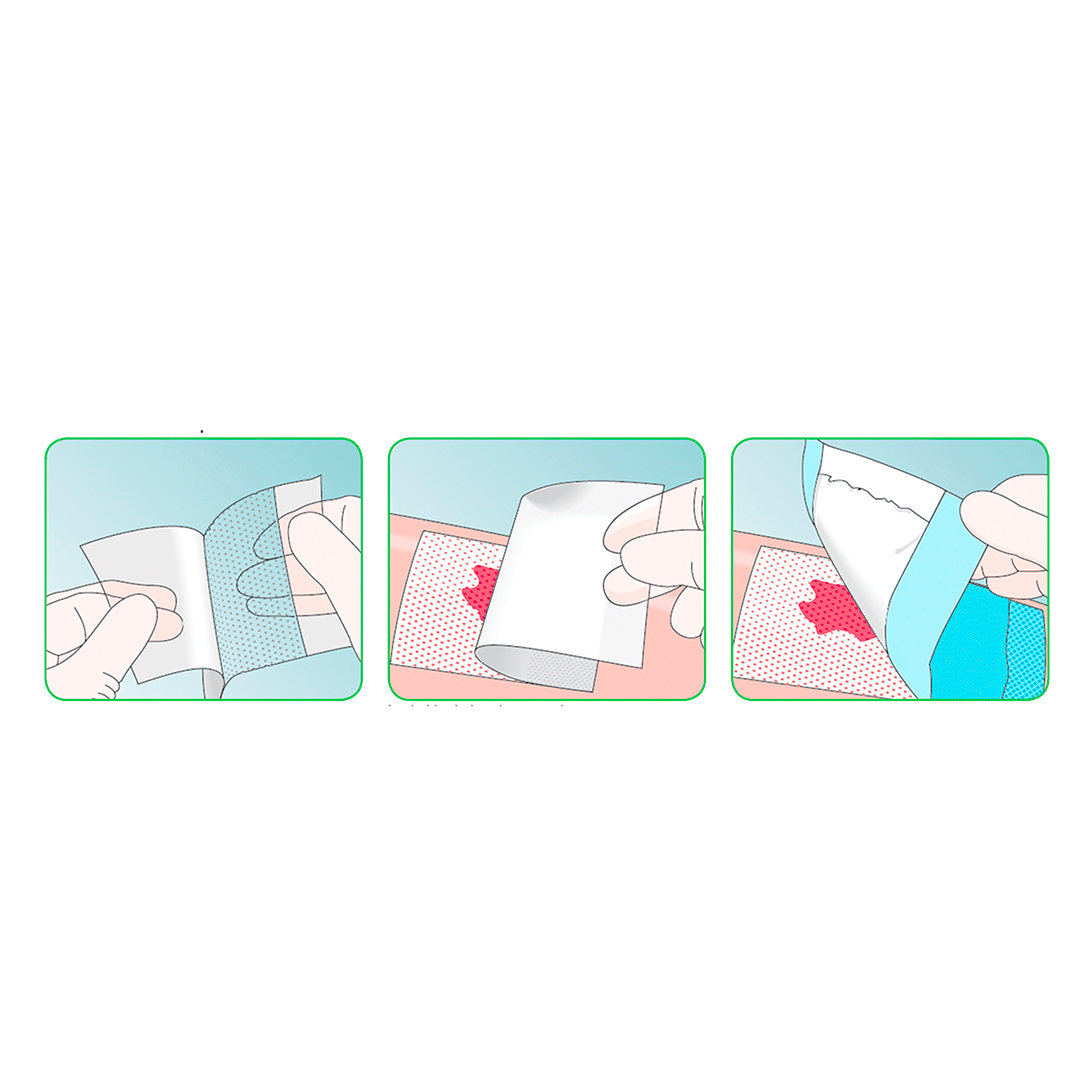 Mepitel 5Cm X 75Mm Packet 10