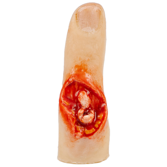 TraumaSim Finger Glove – Exposed Bone Injury