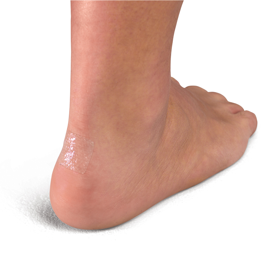 Mueller More Skin 2.5cm Hydrogel Pad Squares 75-Pack for Skin Protection and Healing