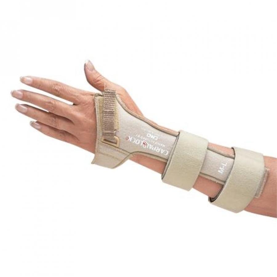 NorthCoast Carpal Lock Splint