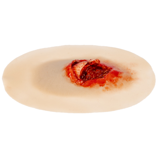 TraumaSim Self-Adhesive Open Fracture