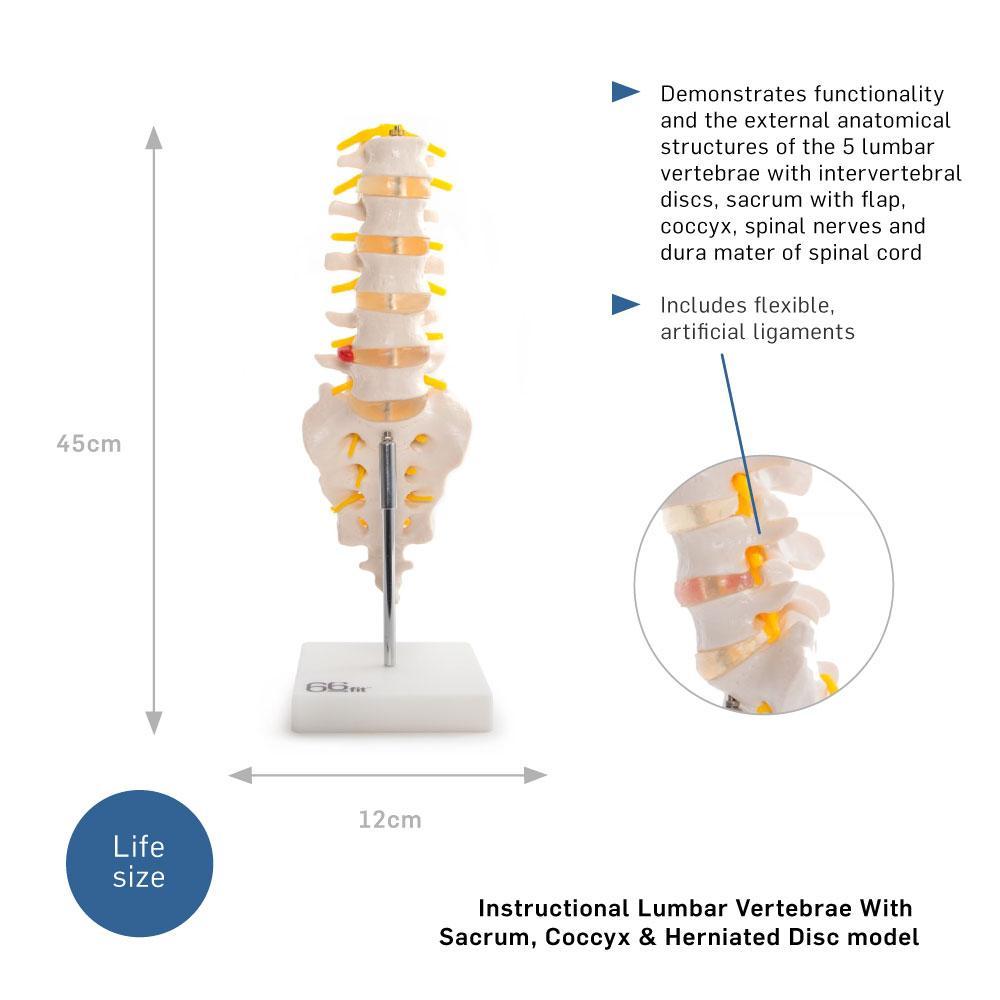 Anatomical Lumbar Vertebrae with Sacrum, Coccyx & Herniated Disc Model - Ideal for Medical Training, Education & Healthcare