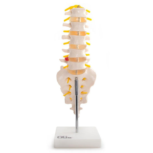 Anatomical Lumbar Vertebrae with Sacrum, Coccyx & Herniated Disc Model - Ideal for Medical Training, Education & Healthcare
