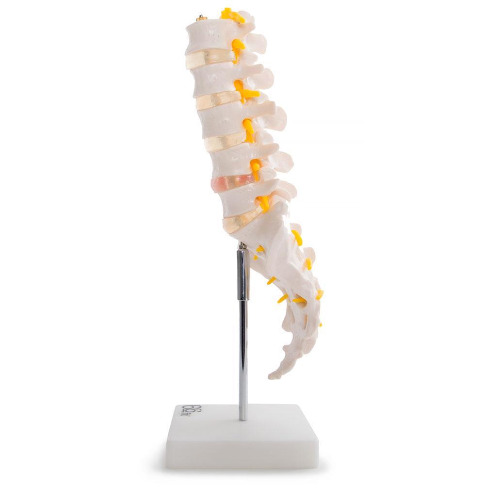 Anatomical Lumbar Vertebrae with Sacrum, Coccyx & Herniated Disc Model - Ideal for Medical Training, Education & Healthcare