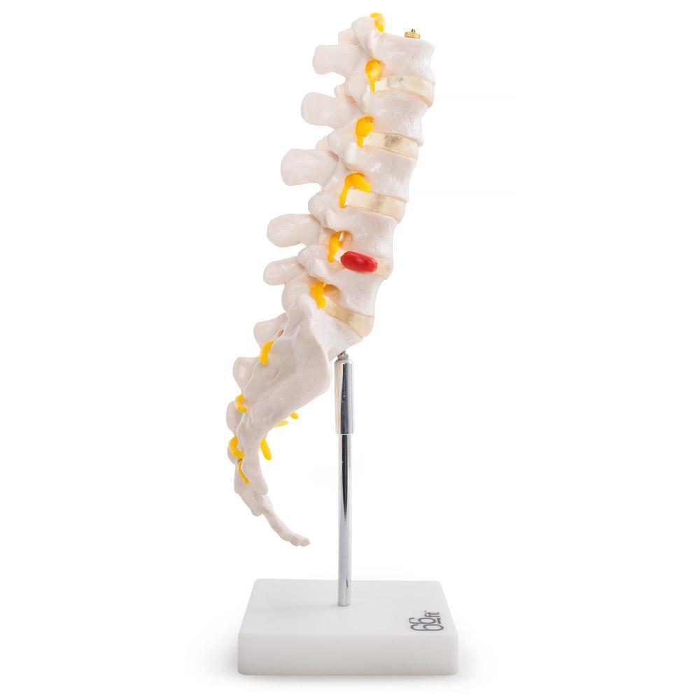 Anatomical Lumbar Vertebrae with Sacrum, Coccyx & Herniated Disc Model - Ideal for Medical Training, Education & Healthcare