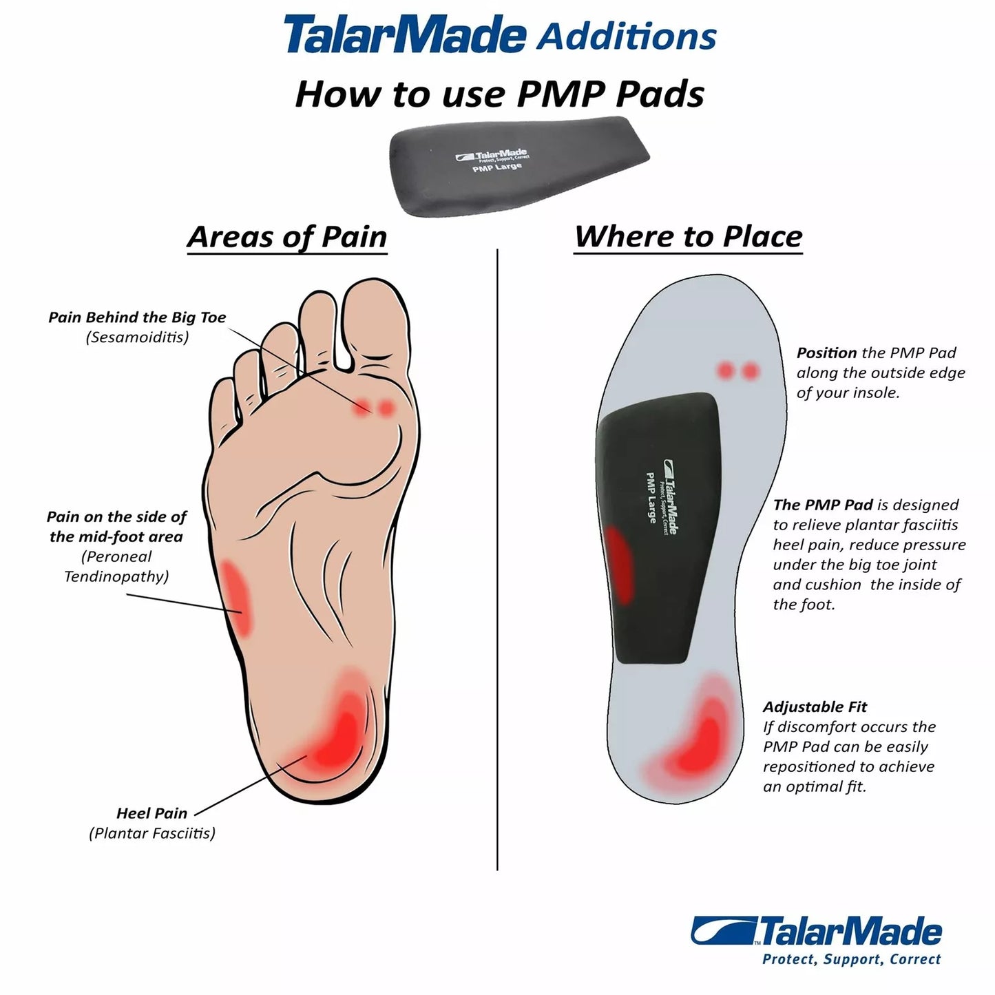 Talarmade PMP Pads - Adjustable and Secure Fixation for Custom Orthotics / Insoles
